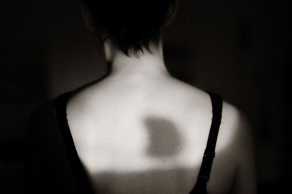 Black and white photo of a woman's bare back with a shadow cast on her skin, wearing a dark strap top.
