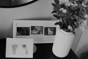 Black and white photo of hospital bracelet and baby footprints on paper.