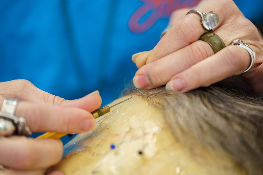 Close-up of therapeutic massage techniques being applied to shoulder muscles.
