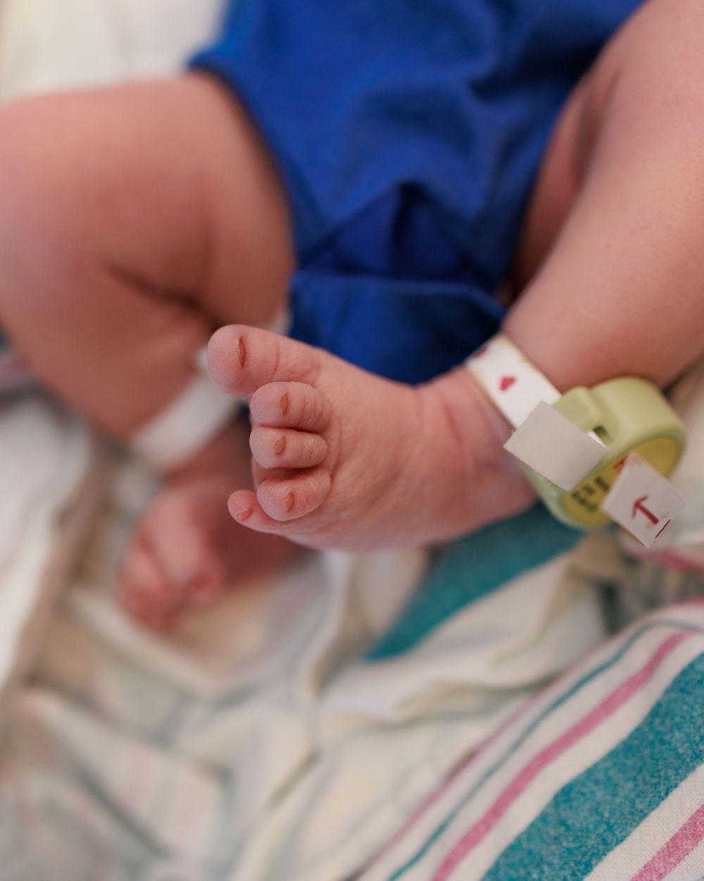 Tiny newborn foot with hospital ID bracelet resting on a striped blanket.
