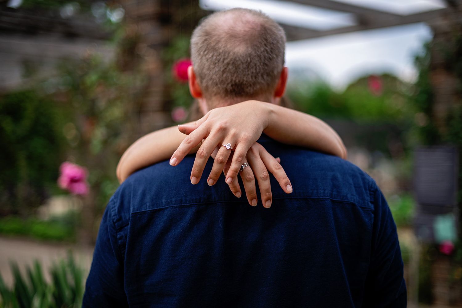 A woman with an engagement ring wraps her arms around a bald man's shoulders in a lush garden setting.