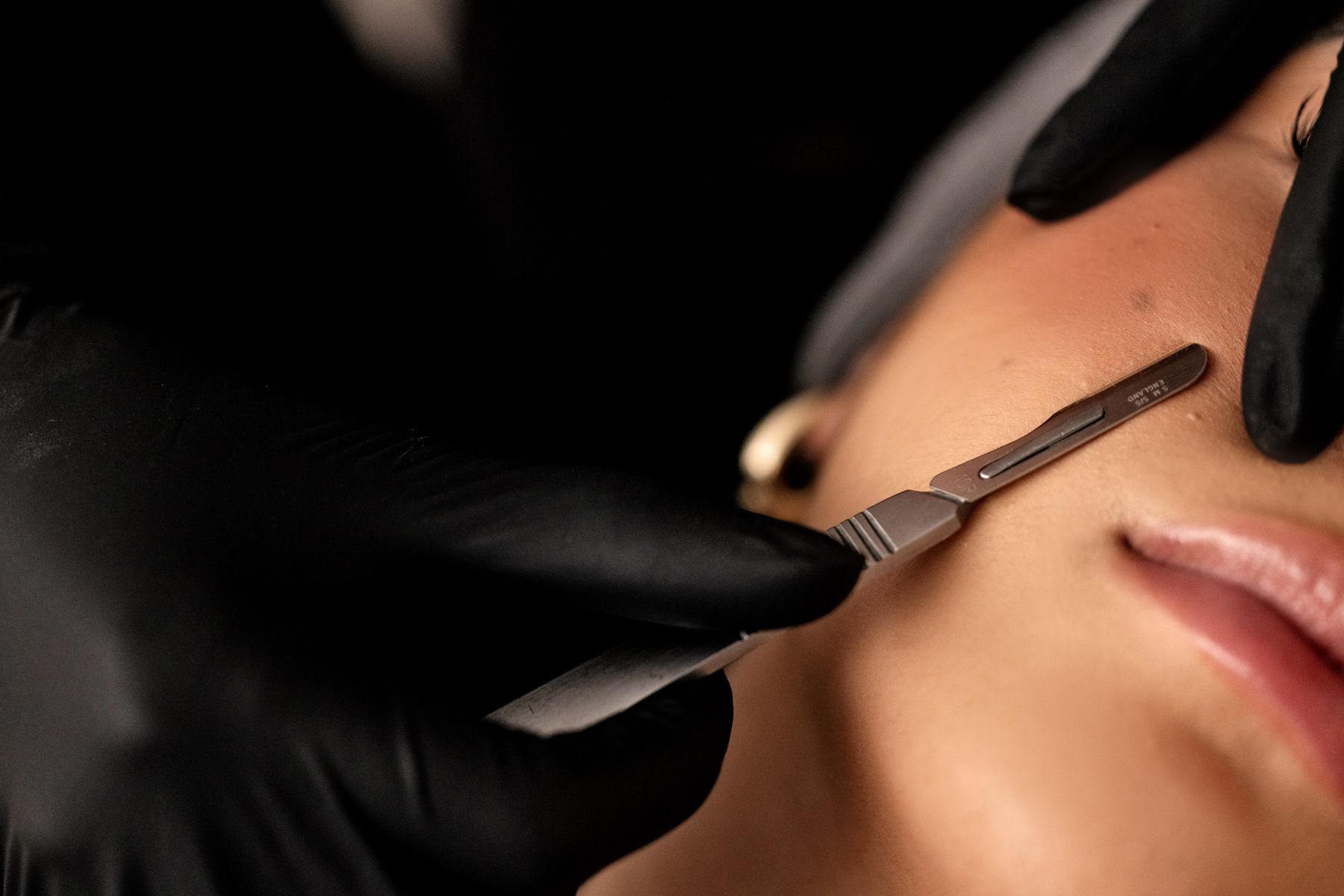 Dermaplaning at Glow Day Spa gently removes dead skin and peach fuzz to reveal soft, smooth, radiant-looking skin.