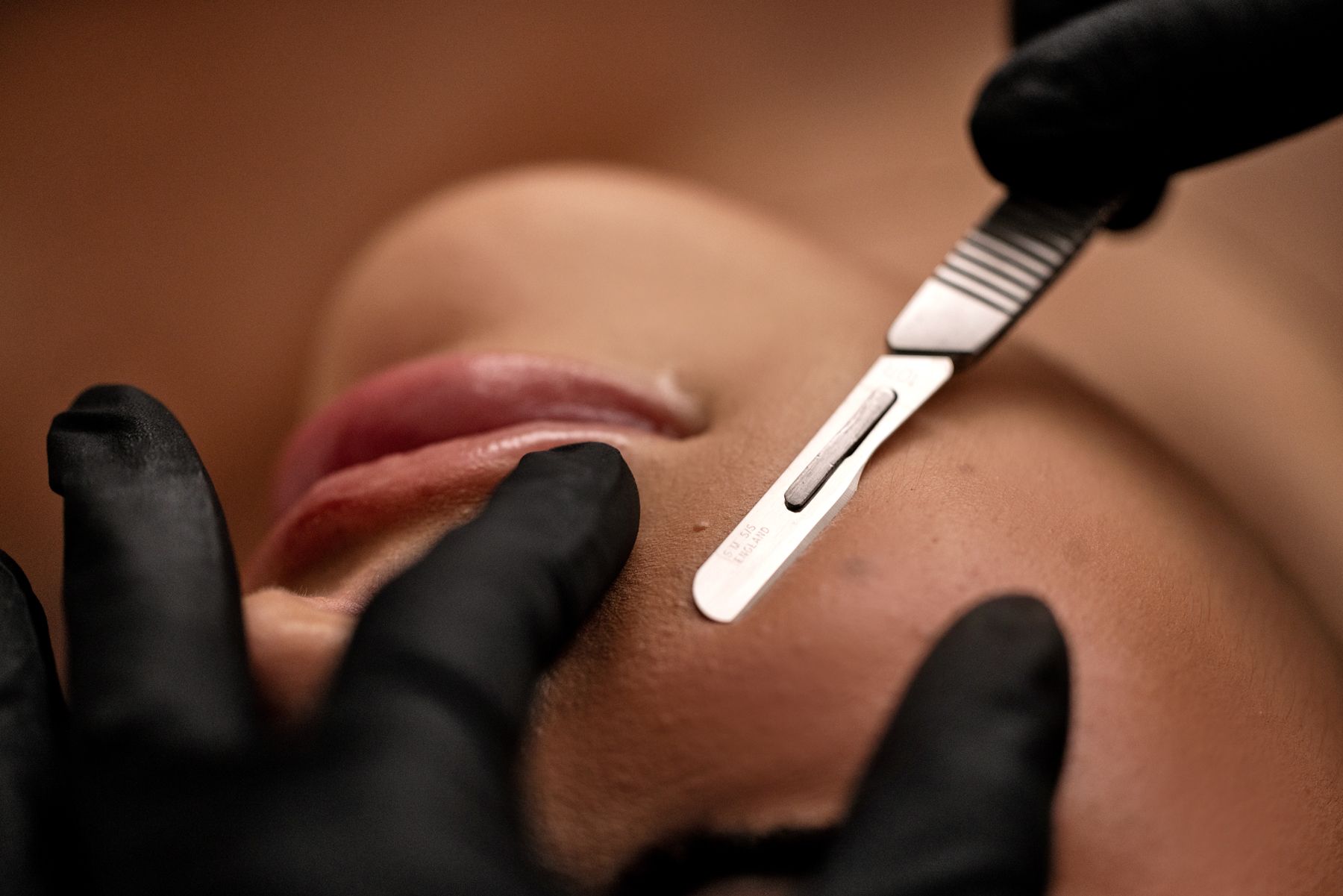 Upgrade your facial with dermaplaning for a smoother finish, improved product absorption, and a fresh, glowing complexion.
