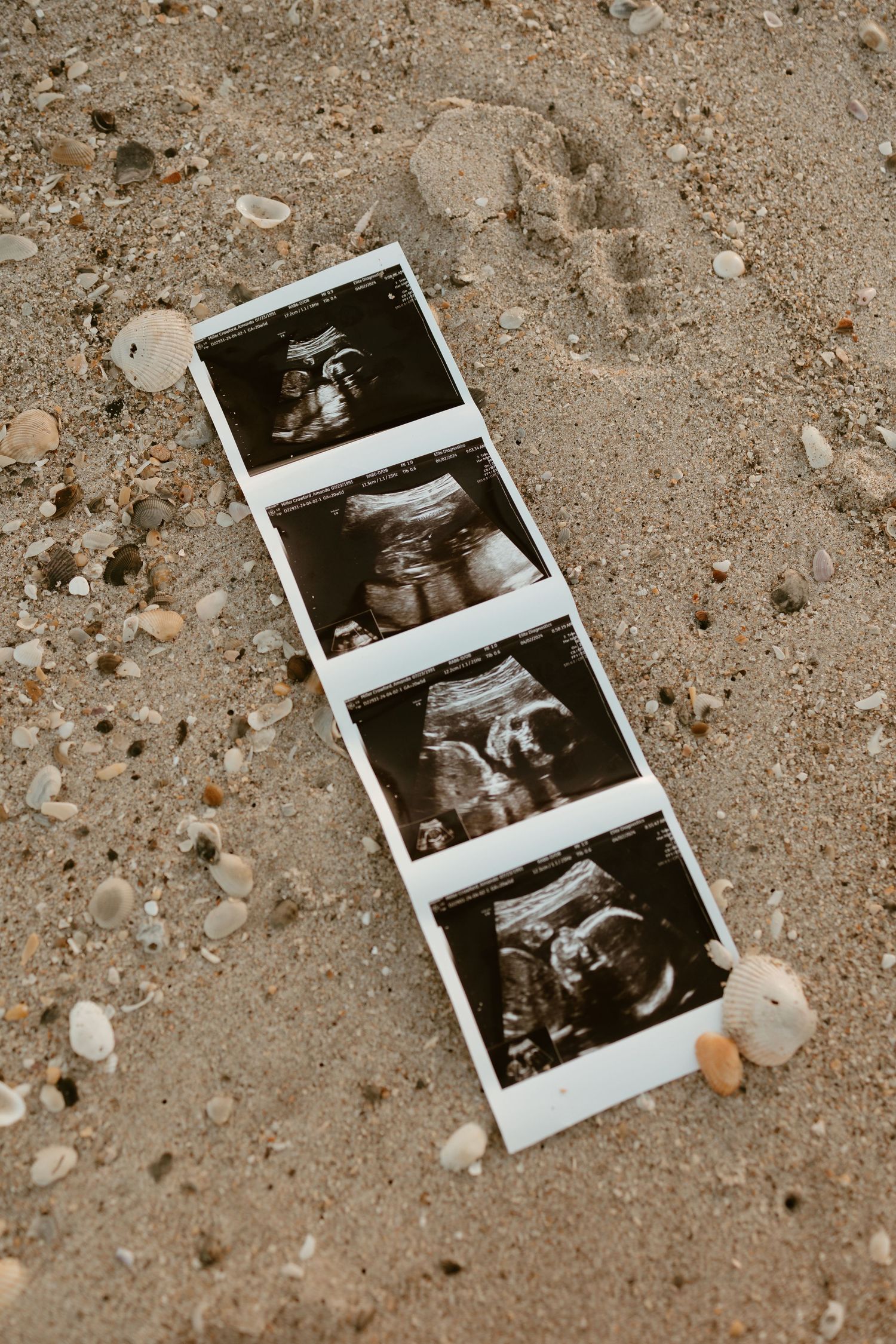 family, couples, newborns, maternity, documentary session, motherhood, pregnancy, sunrise,Satellite beach, cocoa beach, melbourne beach,