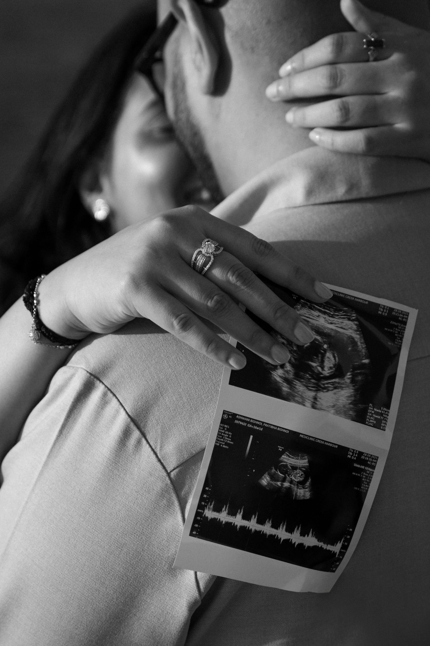 Emotional black and white maternity photo holding ultrasound scan close-up