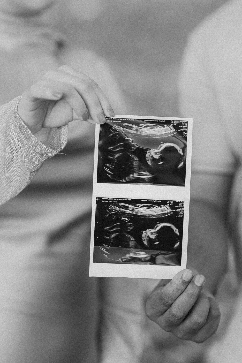 Black and white photo of couple holding ultrasound scan images of their unborn baby.