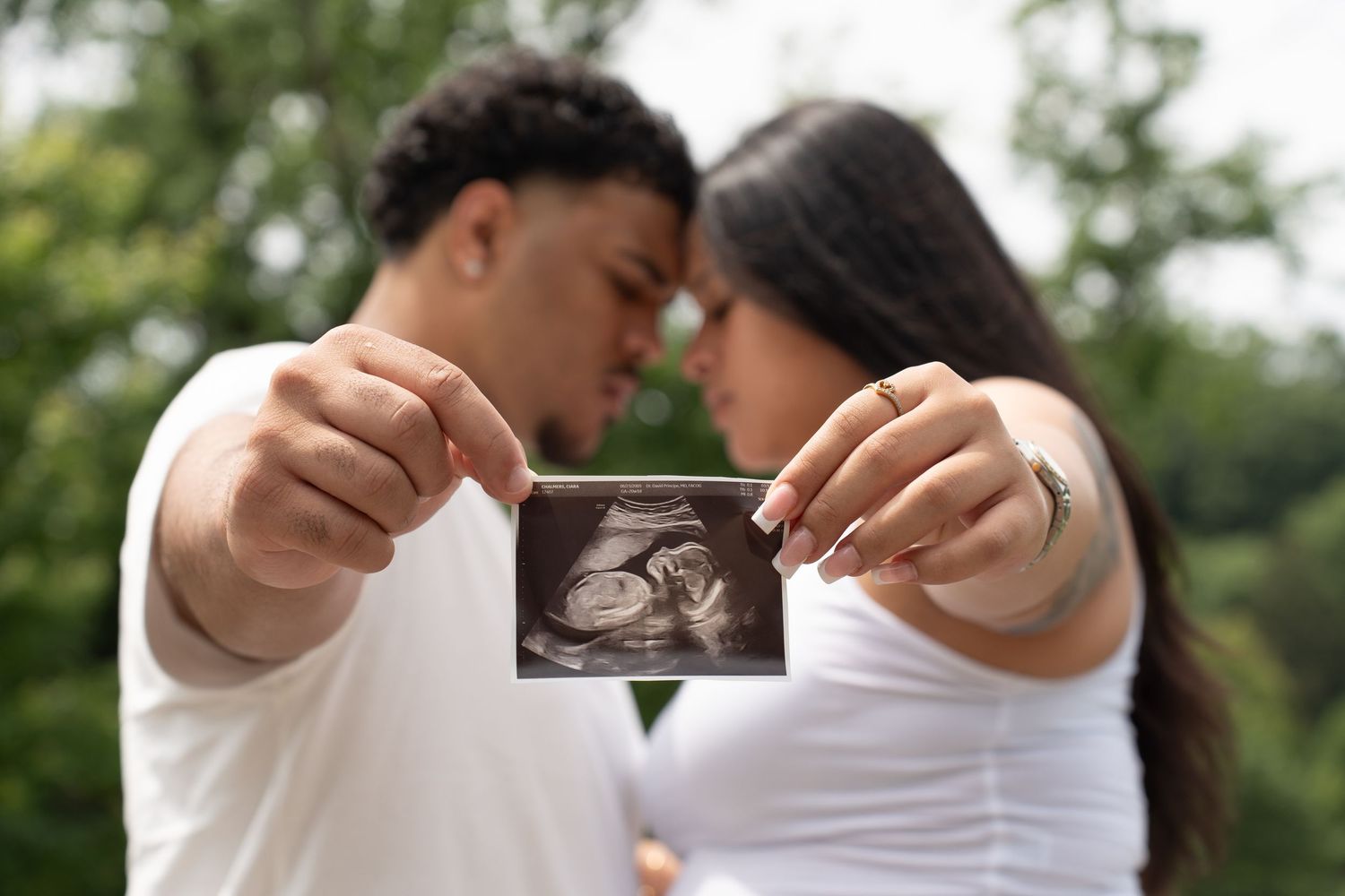 A couple holds up a sonogram photo together in an outdoor setting with green trees in the background.