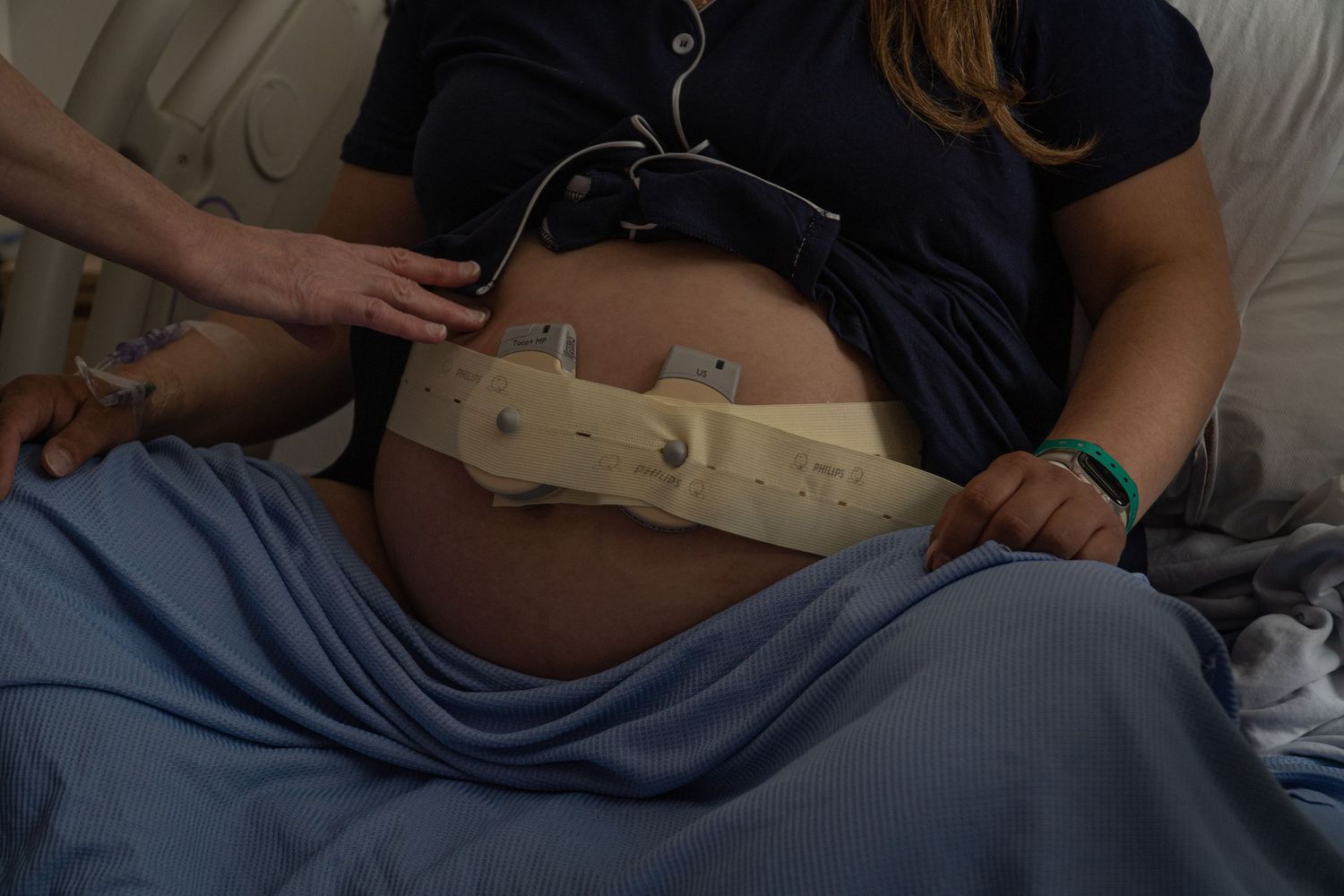 Close-up of a pregnant woman's belly with fetal heart rate monitor straps attached in hospital.