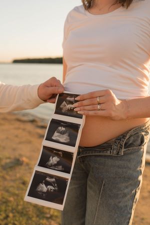 Pregnant woman holding ultrasound sonogram images near her bare belly outdoors by a lake at golden hour.