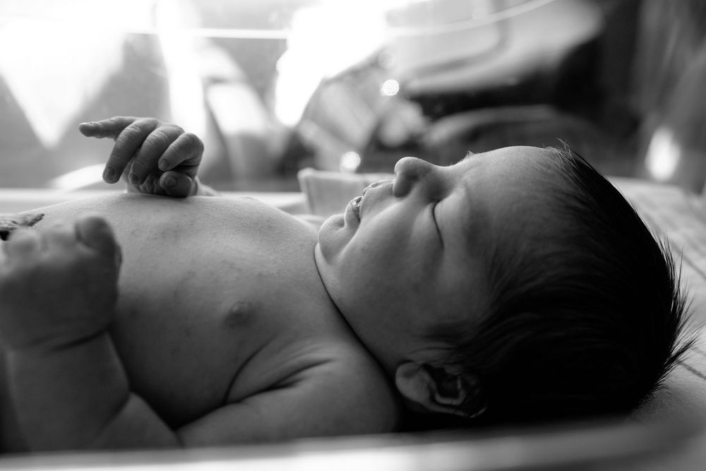 Black and white close-up of a newborn baby lying on their back in a medical setting.