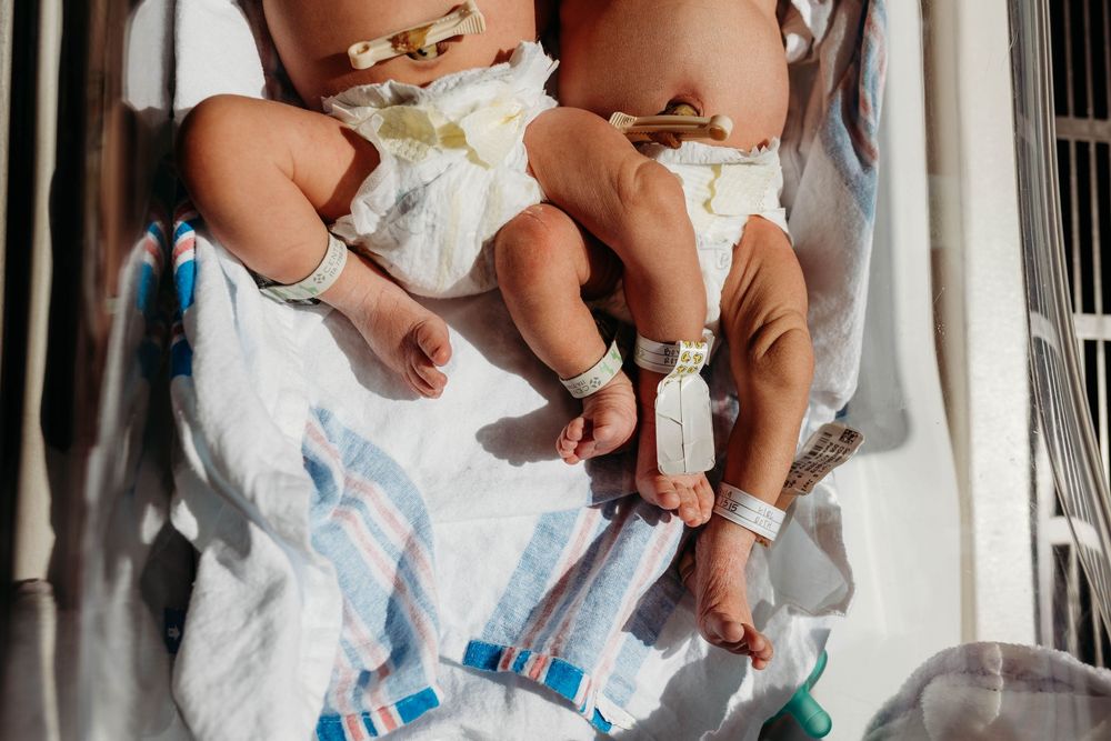 Two newborn twins lying side by side in hospital bassinet wearing ID bracelets.