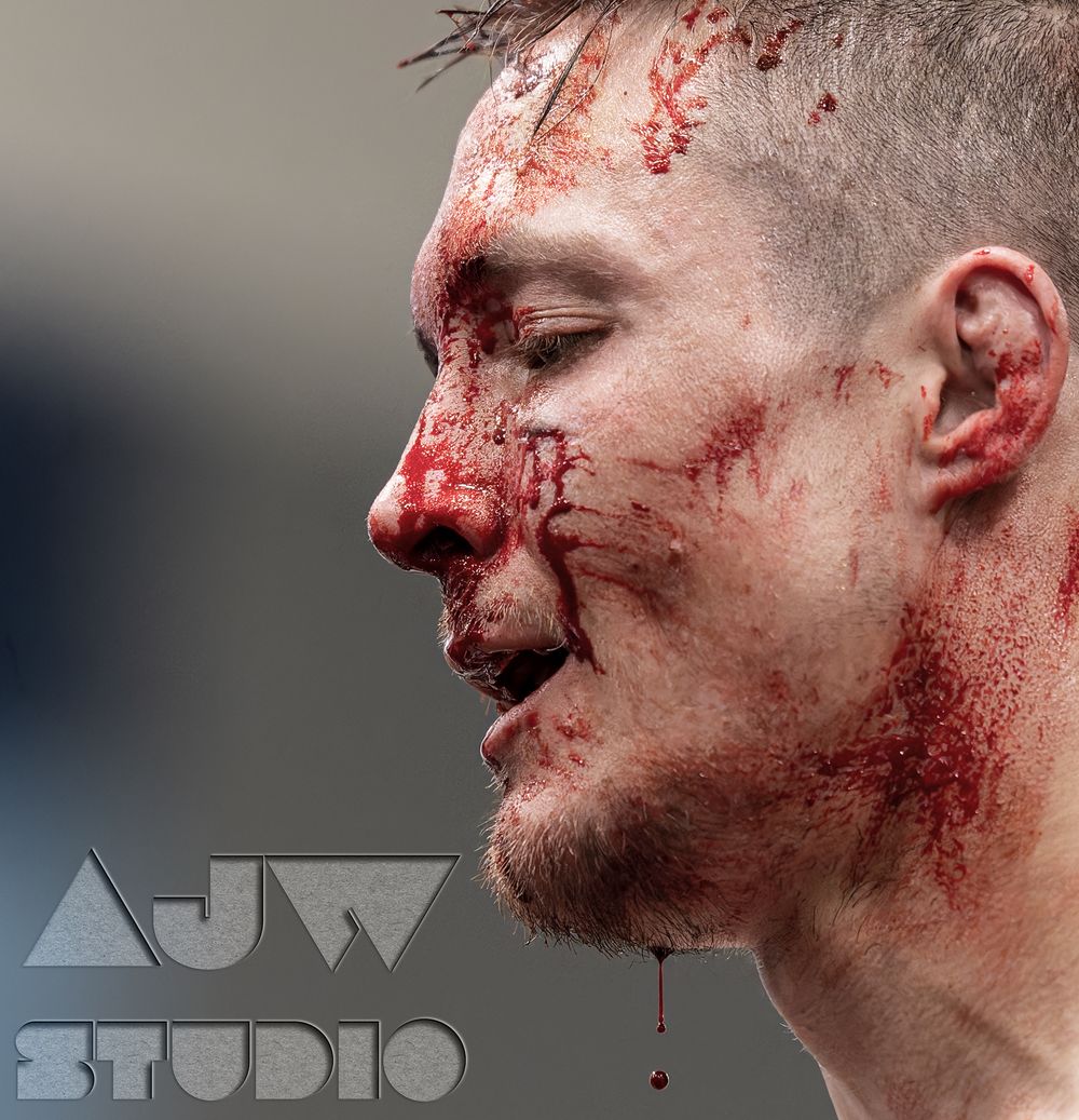 Close up profile view of a combat sports athlete with visible injuries after competition.