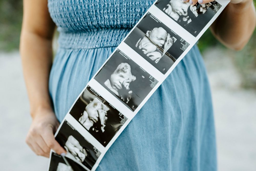 Pregnant woman in blue dress holding ultrasound photo strip showing baby sonogram images outdoors.