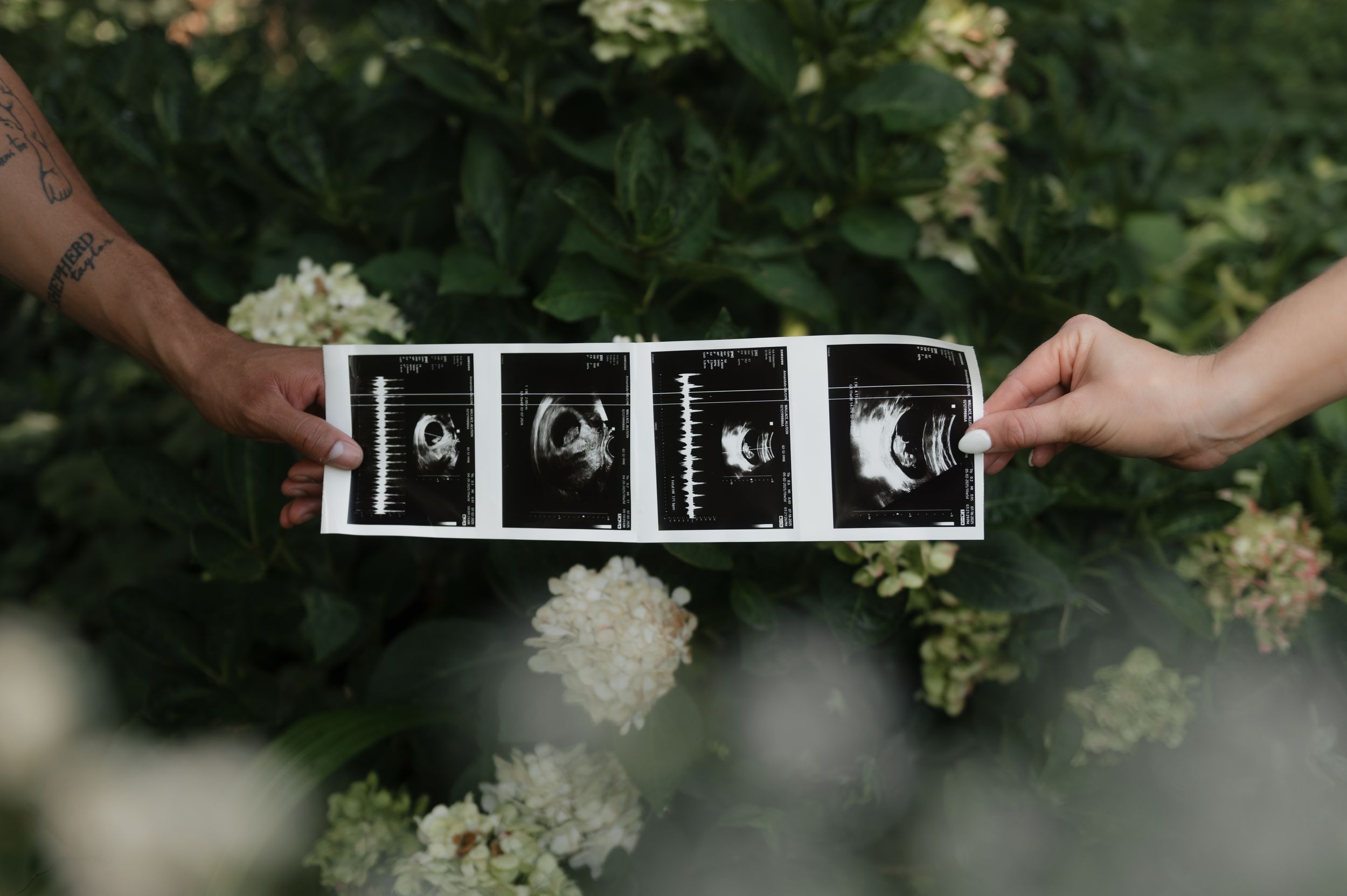 Two hands holding ultrasound scan photos against a background of white flowers and green foliage.