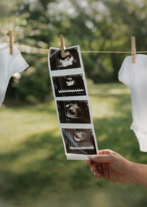 A hand holds up a strip of ultrasound photos hanging on a clothesline with white onesies against a blurred green background.