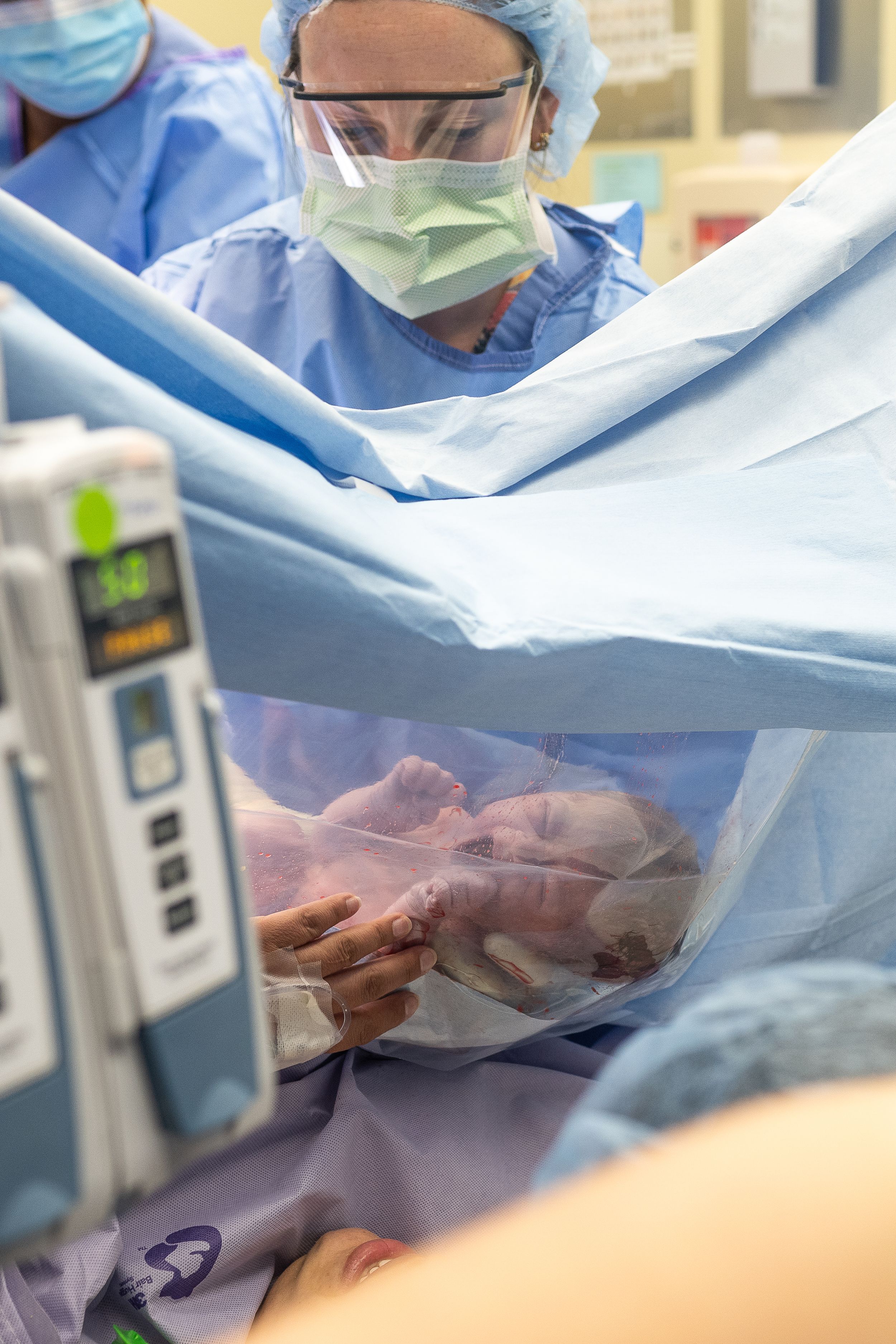 Cesarean section at Vanderbilt University Medical Center documented by Disney Magic Photography, local Nashville newborn photographer.