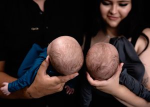 Parents gently hold two newborn twins with similar bald heads during a heartwarming family photo session.#Carlsbad #TwinNewbornPhotographer