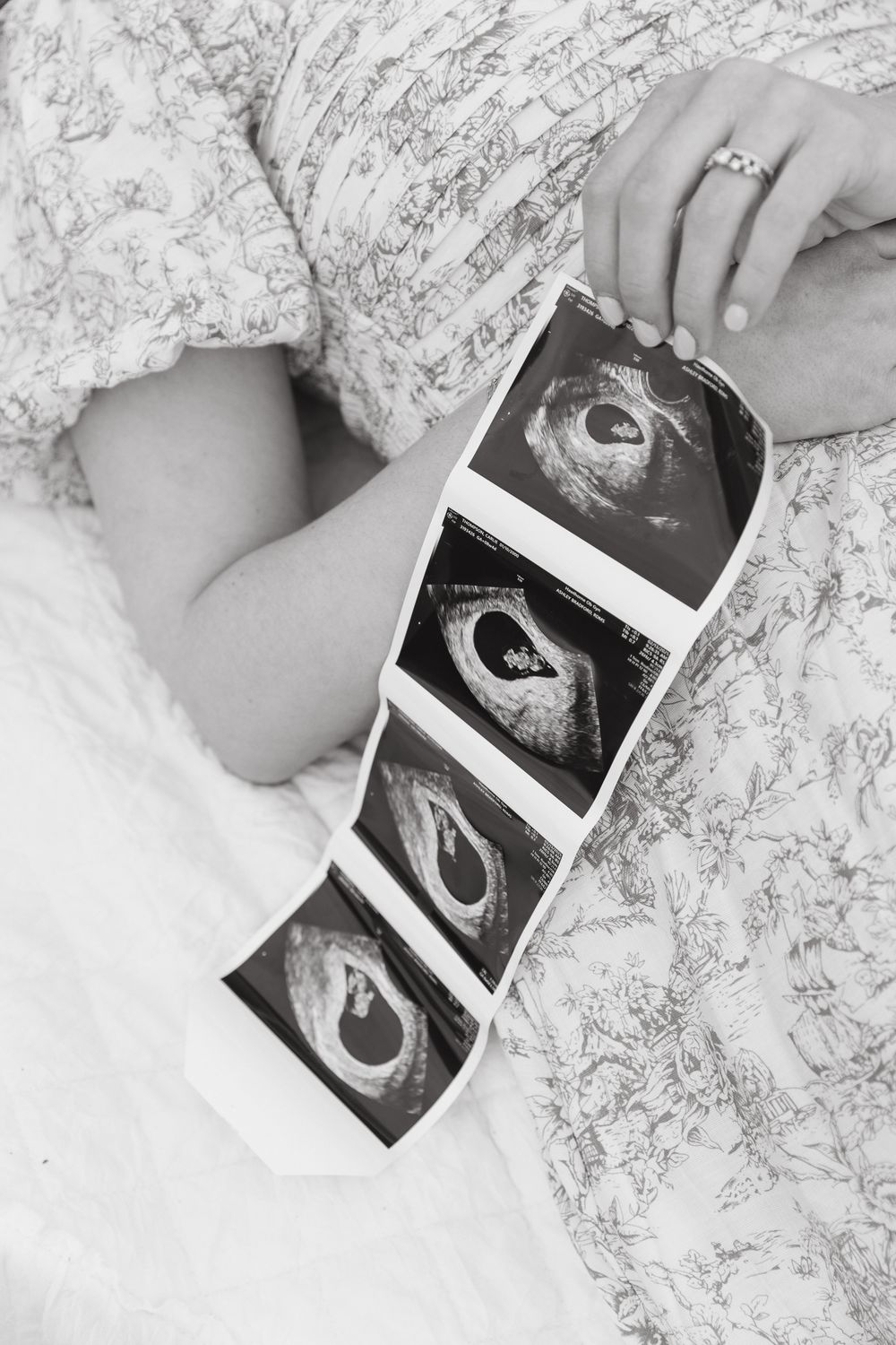 Black and white photo of pregnant woman holding ultrasound sonogram strip while sitting on a floral bed.