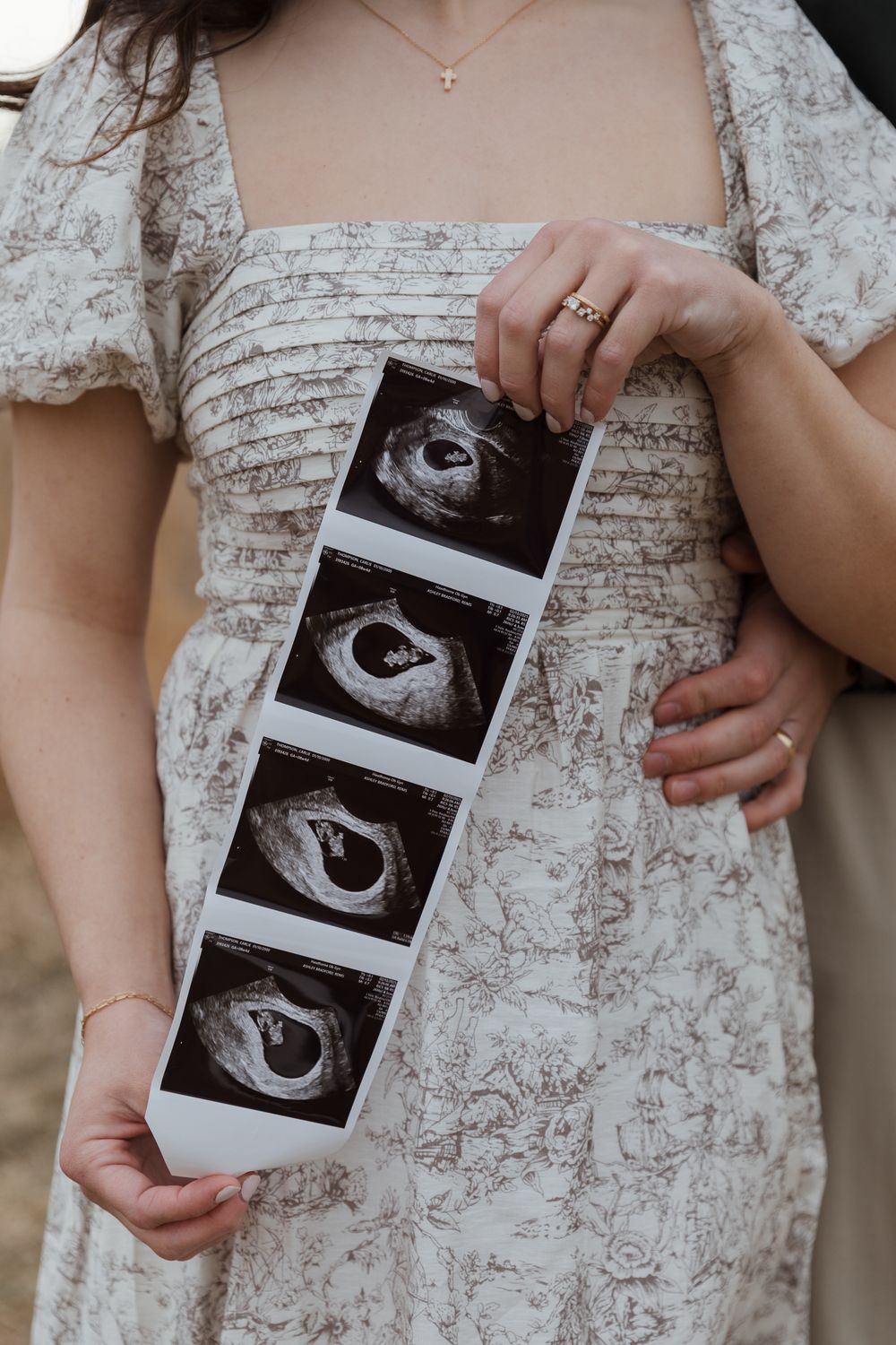 Pregnant woman in floral dress holding ultrasound sonogram strip showing four baby scan images.