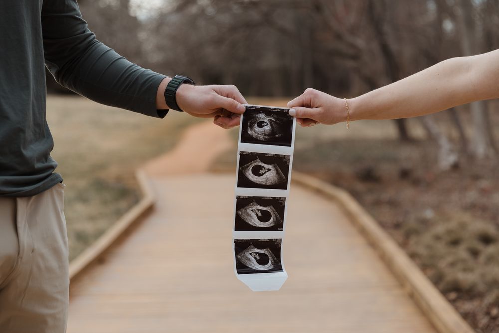 Couple holding ultrasound strip photos together on a wooden pathway in a park.