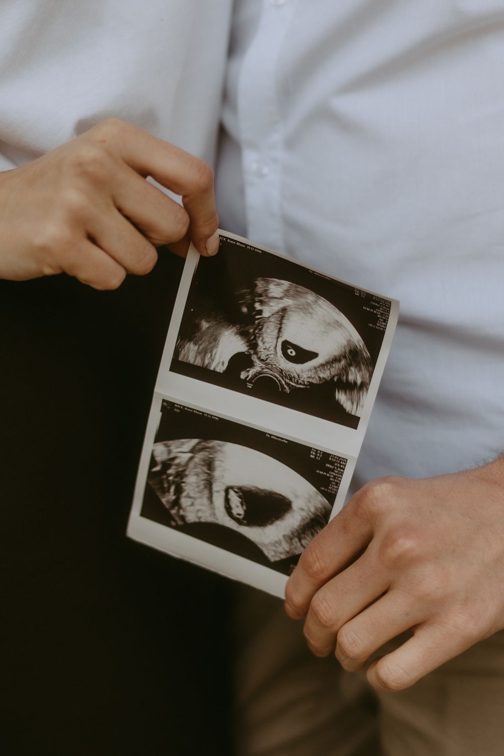Couple holding ultrasound photos together, announcing pregnancy while dressed in white and black.