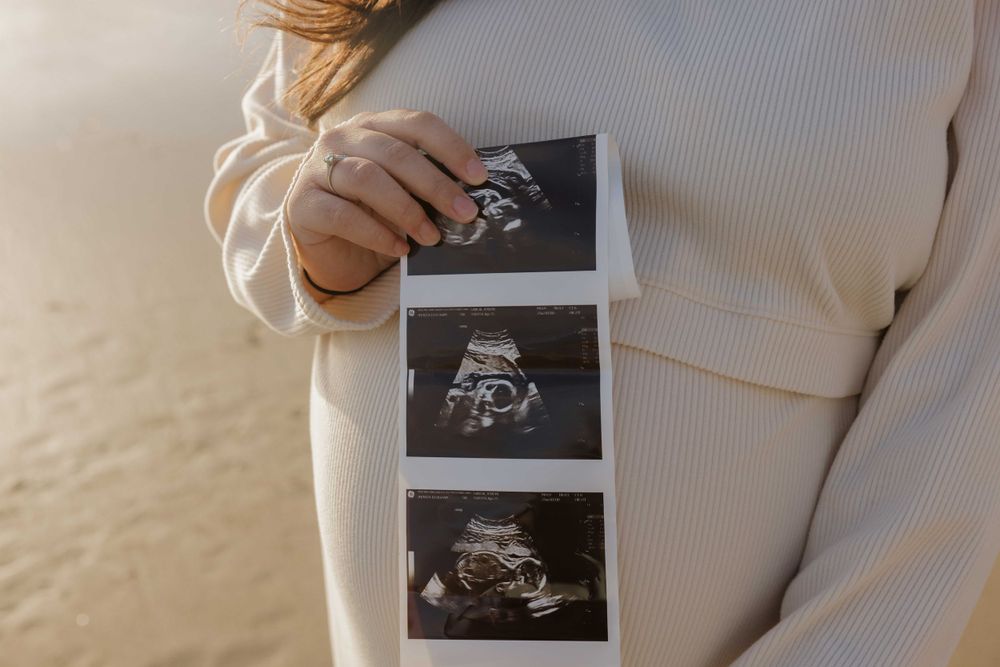 Someone in a cream sweater holds three black and white ultrasound photos in their hand.