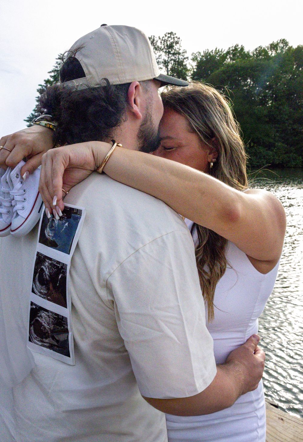 Couple embracing and kissing outdoors near a lake, man wearing white shirt with ultrasound photos, pregnancy announcement.
