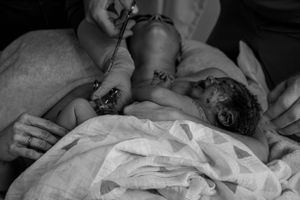 Birth Photography