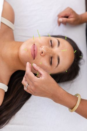 woman acupuncturist branding photo in Issaquah, WA with client acupressure treatment aesthetic facial using needs on woman's face