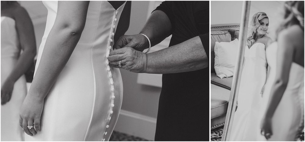 A series of black and white medical or clinical photos showing close-up details of hands and arms.