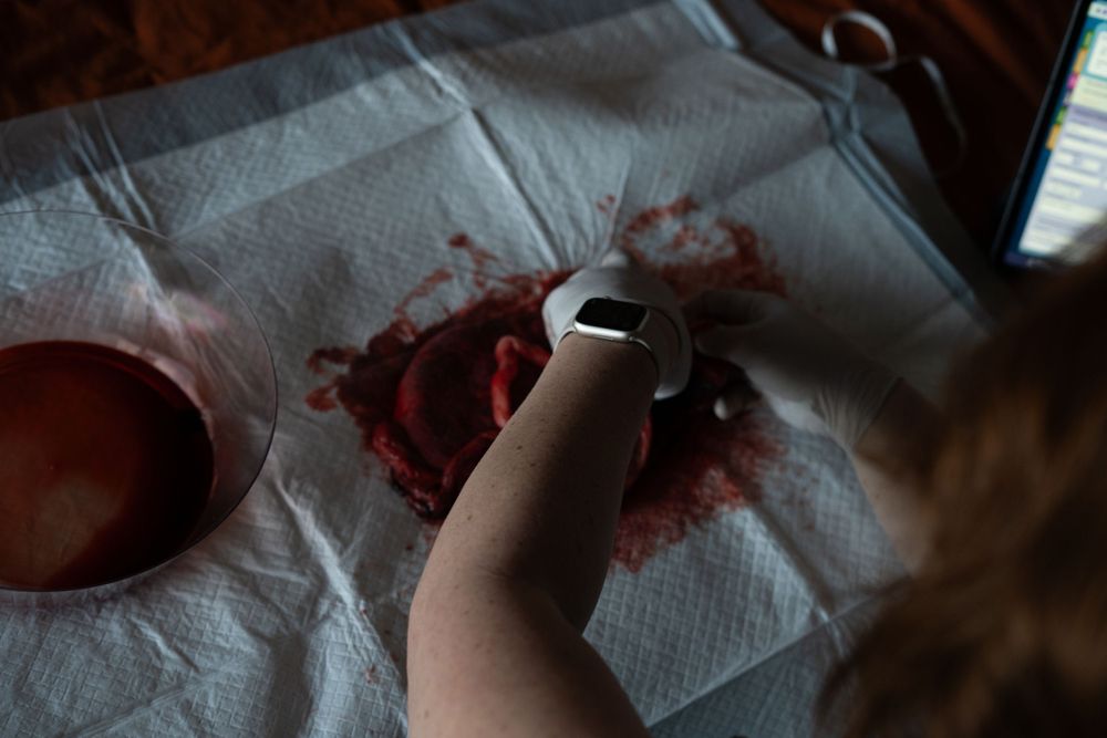 A healthy placenta typically has a round or oval shape. Ensuring the placenta is complete and intact.