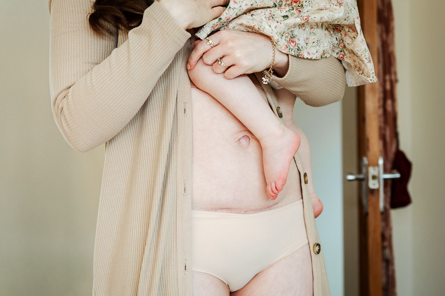 A toddler's feet dangle next to her mum's c-section scar at an in home caesarean birth photoshoot in Bristol with Little Bodhi Photography