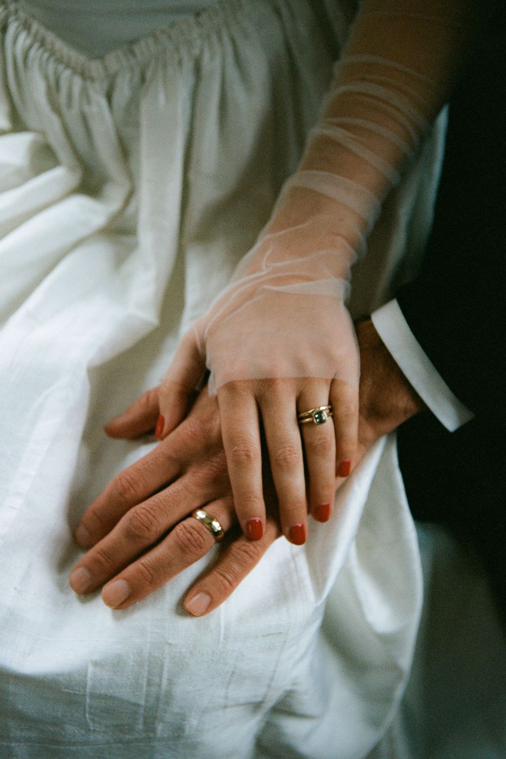 Close-up of hands with wedding ring resting on white fabric.
