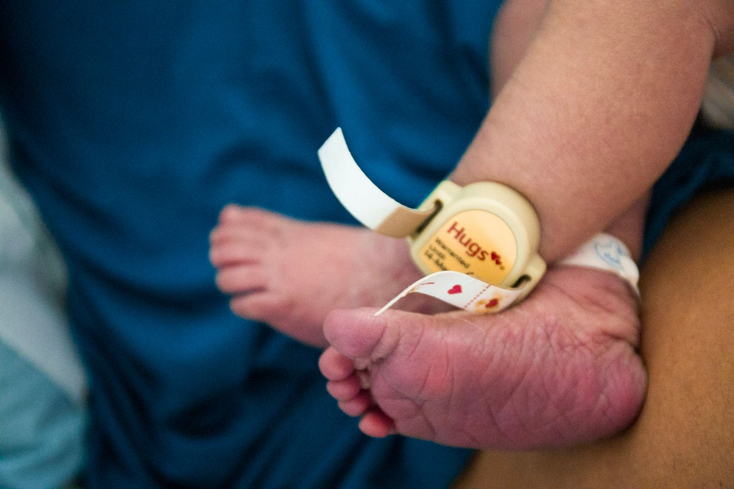 Newborn baby feet with hospital identification band and monitoring device.