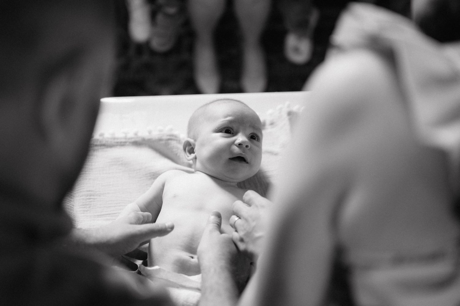 A black and white photo of a baby lying down seen from above while being examined.