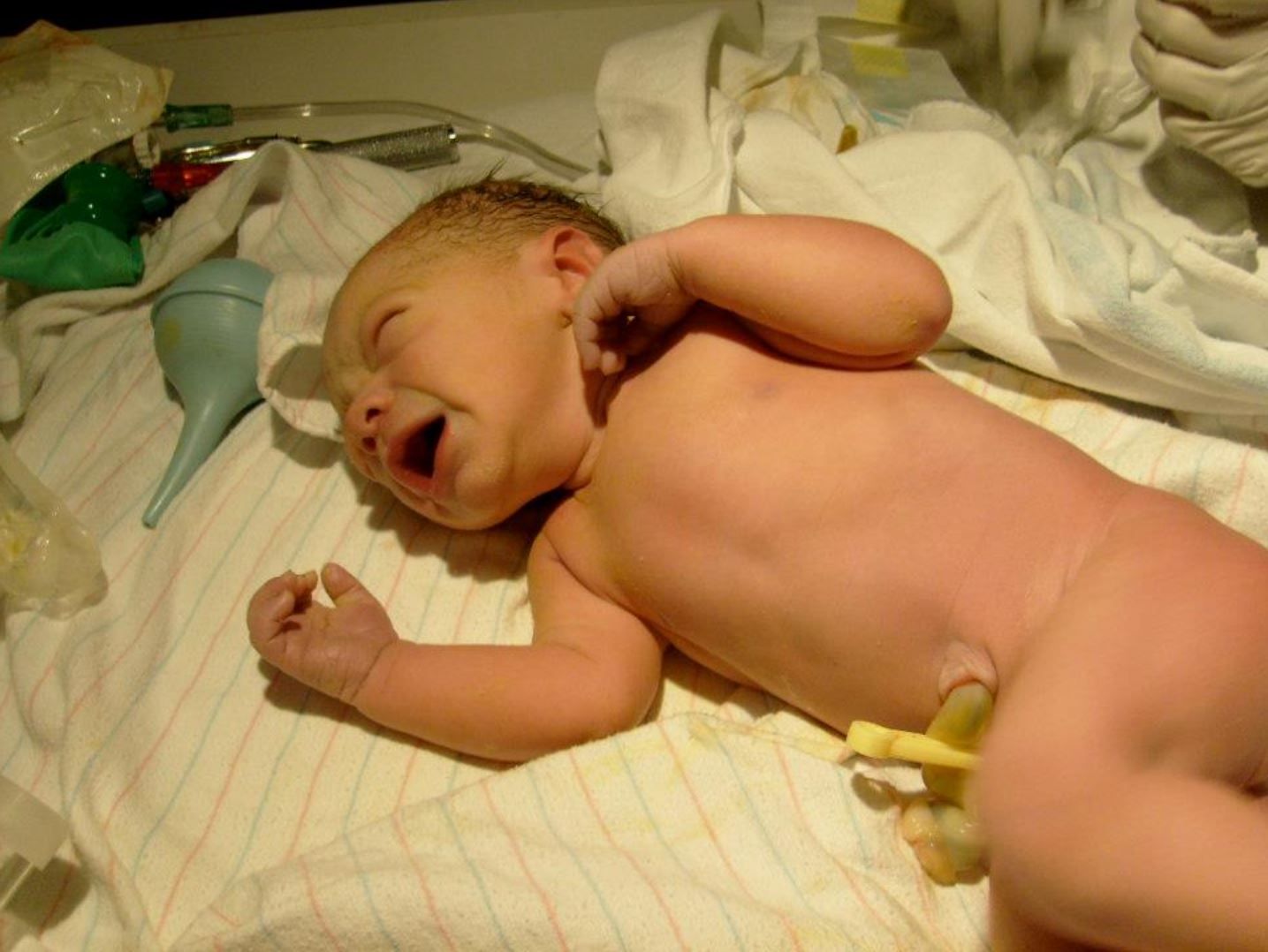 Newborn baby sleeping peacefully on white linens after birth.