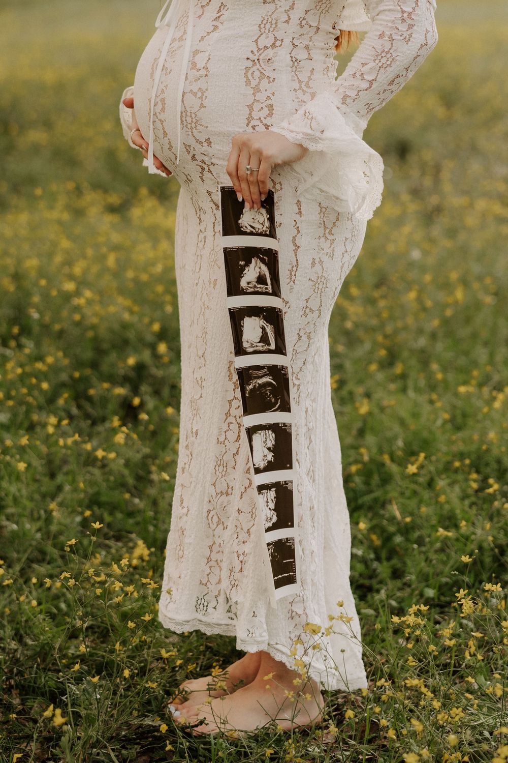 A white lace dress photographed in a field of yellow wildflowers with vintage photos displayed on the fabric.
