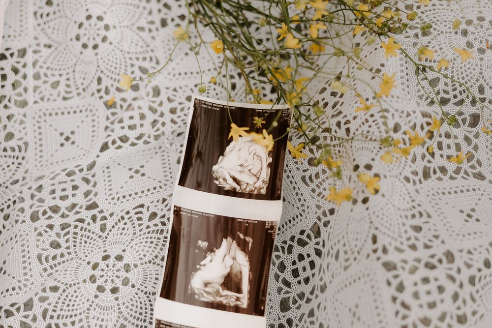 Vintage sepia photographs displayed on a wall with delicate yellow flowers and lace doilies creating a nostalgic arrangement.