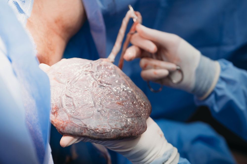 Surgeon's gloved hands carefully examine the placenta after birth.