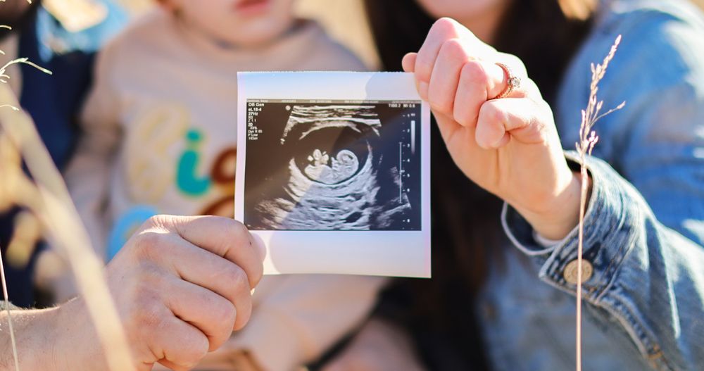 Hand holding an ultrasound sonogram photo showing a developing baby in black and white.
