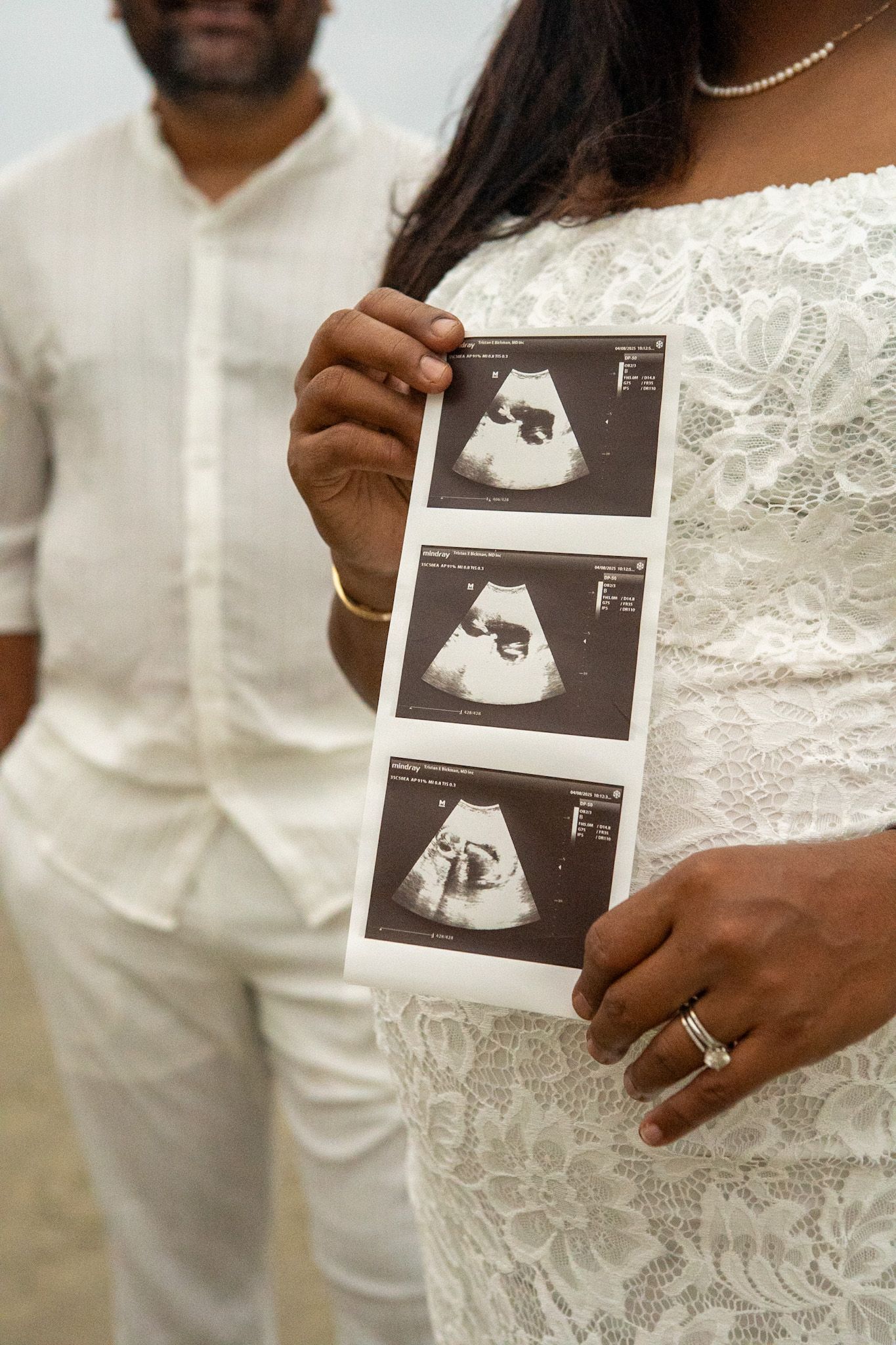 Couple holding ultrasound sonogram images in formal white attire.
