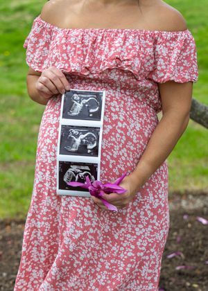 A person in a pink floral dress holds ultrasound photos while standing in a garden setting.