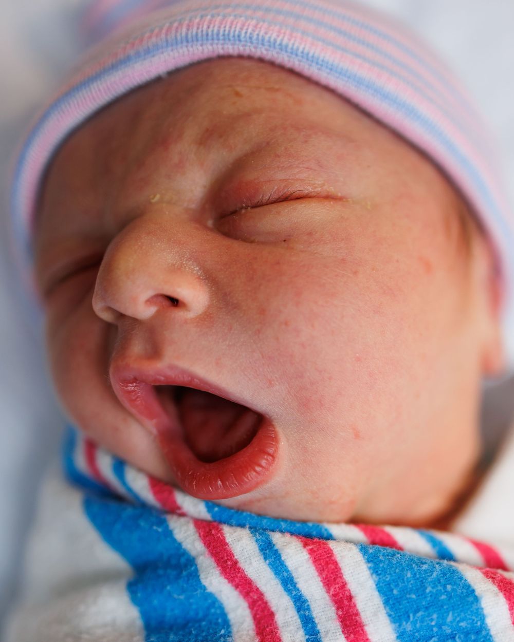 A newborn wearing a pink and blue striped hat and striped blanket is yawning widely.