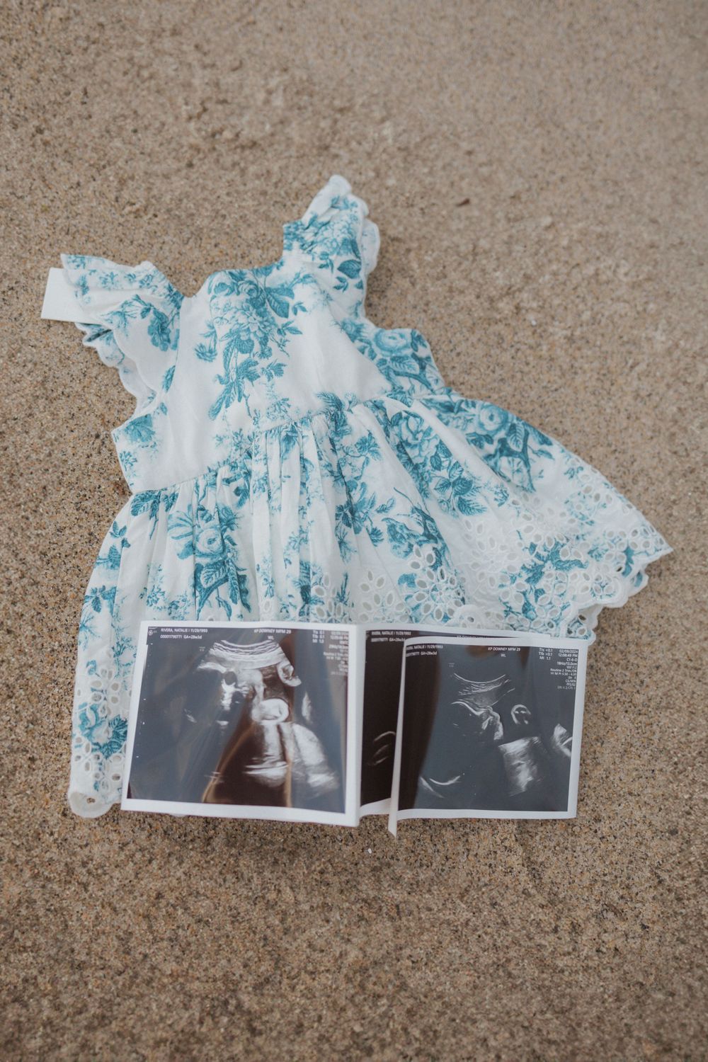 A blue floral dress and ultrasound photos laid out on sand at the beach.