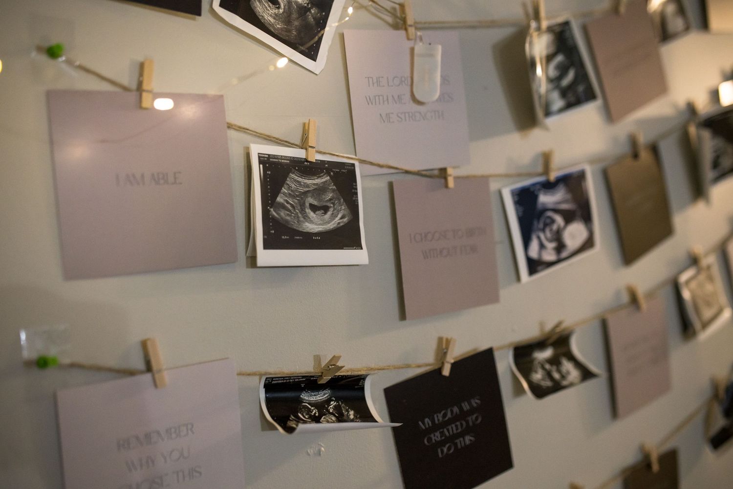 Award winning birth photographer northern Virginia