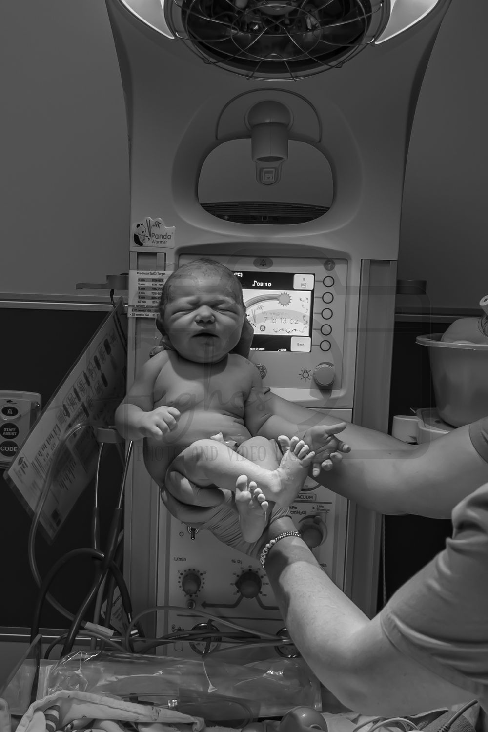 Newborn baby being examined under medical lights after delivery.
