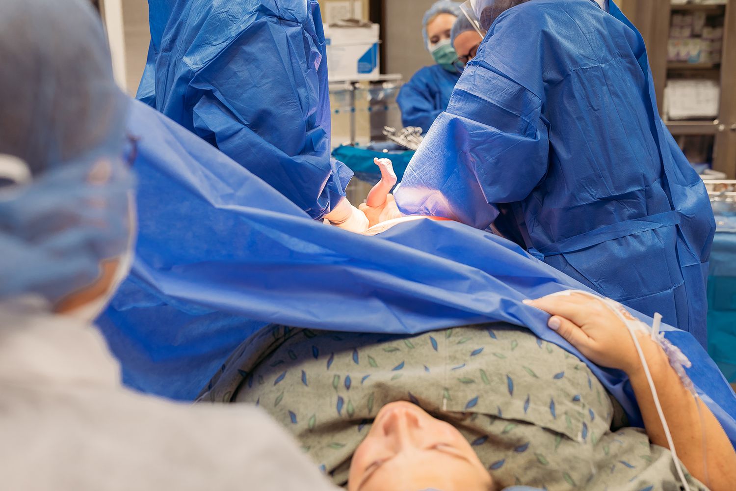 Medical team in blue surgical gowns performing an operation on a patient in a hospital operating room.