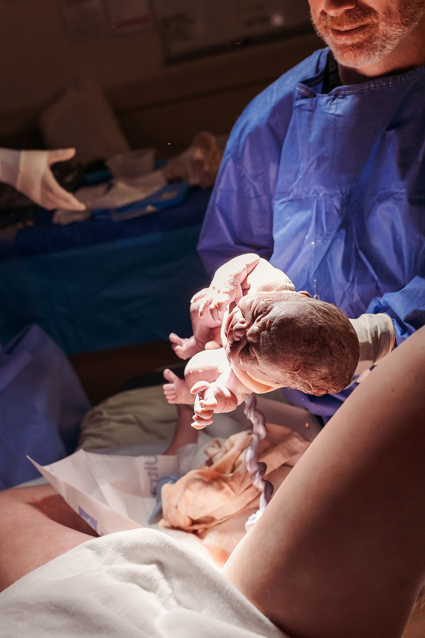 Medical team performing surgery in operating room with blue surgical gowns and bright lighting.