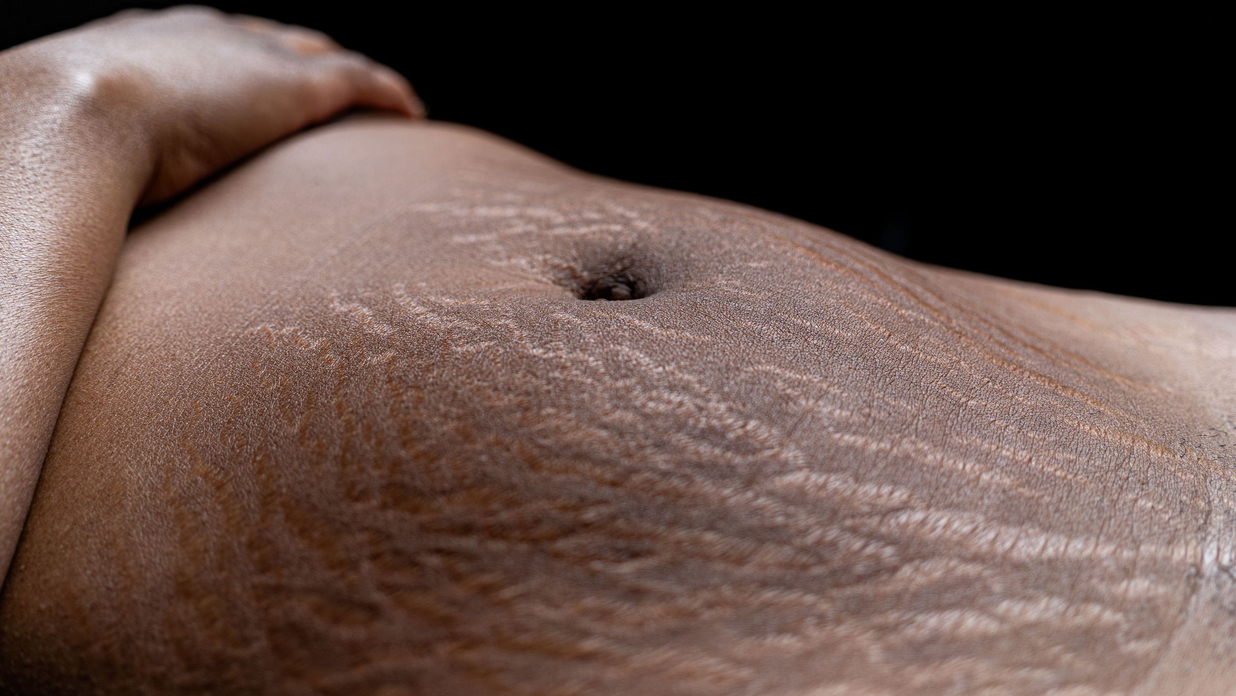 Close-up view of a belly button against a black background showing skin texture and detail.