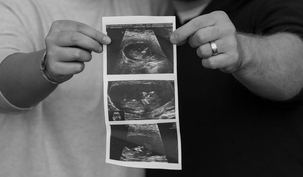 Couple holding ultrasound photos in black and white pregnancy announcement.